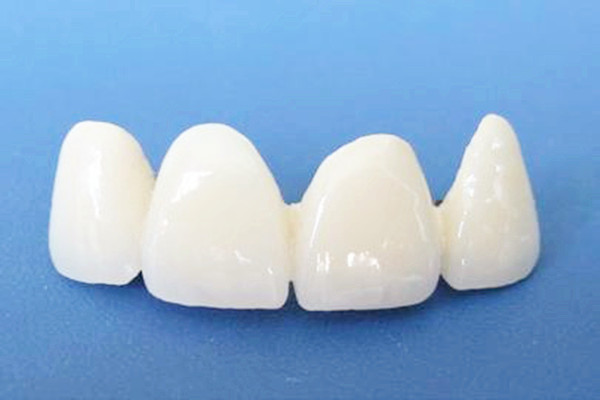 烤瓷牙會導(dǎo)致臉變形嗎 烤瓷牙會導(dǎo)致牙齦萎縮嗎 烤瓷牙會導(dǎo)致臉變形嗎 烤瓷牙會導(dǎo)致牙齦萎縮嗎