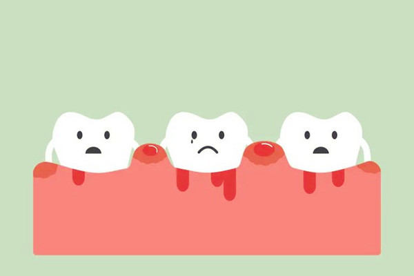 烤瓷牙會導(dǎo)致臉變形嗎 烤瓷牙會導(dǎo)致牙齦萎縮嗎 烤瓷牙會導(dǎo)致臉變形嗎 烤瓷牙會導(dǎo)致牙齦萎縮嗎