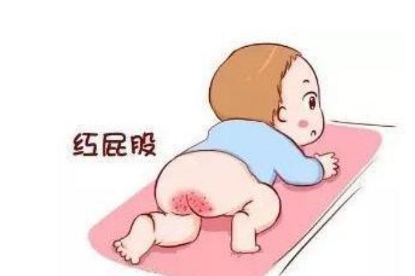 寶寶紅屁股擦什么好得快 寶寶紅屁股破了怎么處理 寶寶紅屁股擦什么好得快 寶寶紅屁股破了怎么處理