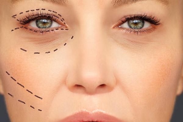 眼袋為什么有脂肪粒 眼袋為什么一個(gè)大一個(gè)小 眼袋為什么有脂肪粒 眼袋為什么一個(gè)大一個(gè)小