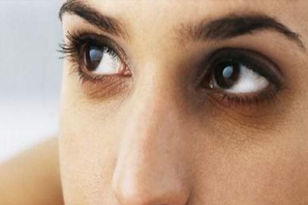 眼袋能熱敷嗎 眼袋是熱敷還是冷敷 眼袋能熱敷嗎 眼袋是熱敷還是冷敷