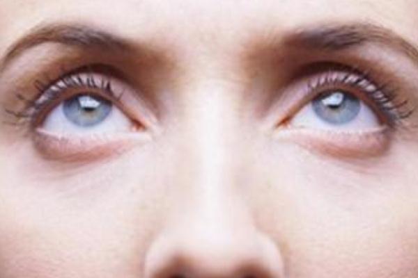 眼袋腫了怎么辦才能消腫 眼袋浮腫怎么回事 眼袋腫了怎么辦才能消腫 眼袋浮腫怎么回事