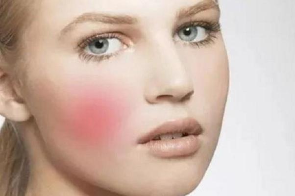 敏感肌要用清潔面膜嗎 敏感肌會自己恢復(fù)嗎 敏感肌要用清潔面膜嗎 敏感肌會自己恢復(fù)嗎