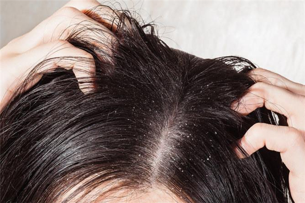 油性頭發(fā)可以用護(hù)發(fā)精油嗎 油性頭發(fā)用護(hù)發(fā)精油好不好 油性頭發(fā)可以用護(hù)發(fā)精油嗎 油性頭發(fā)用護(hù)發(fā)精油好不好