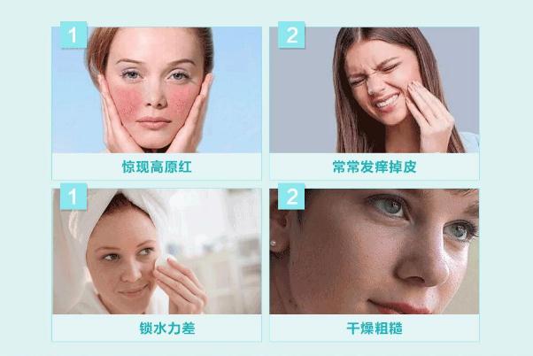 敏感肌怎樣修復成正常肌膚 敏感肌膚適合什么牌子的護膚品 敏感肌怎樣修復成正常肌膚 敏感肌膚適合什么牌子的護膚品