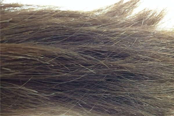 頭發(fā)有分叉會不會影響頭發(fā)的生長 頭發(fā)有分叉的原因 頭發(fā)有分叉會不會影響頭發(fā)的生長 頭發(fā)有分叉的原因