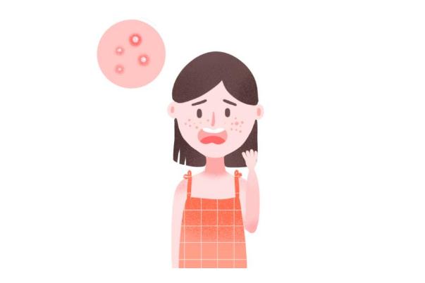 粉刺要不要擠出來 粉刺要怎么處理 粉刺要不要擠出來 粉刺要怎么處理