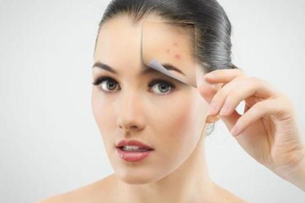 粉刺有硬塊但是擠不出來怎么辦 粉刺會(huì)傳染給別人嗎 粉刺有硬塊但是擠不出來怎么辦 粉刺會(huì)傳染給別人嗎