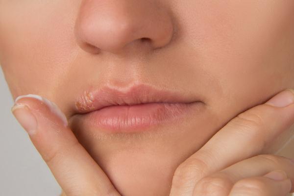 唇毛會(huì)自己慢慢消失嗎 唇毛會(huì)自己脫落嗎 唇毛會(huì)自己慢慢消失嗎 唇毛會(huì)自己脫落嗎