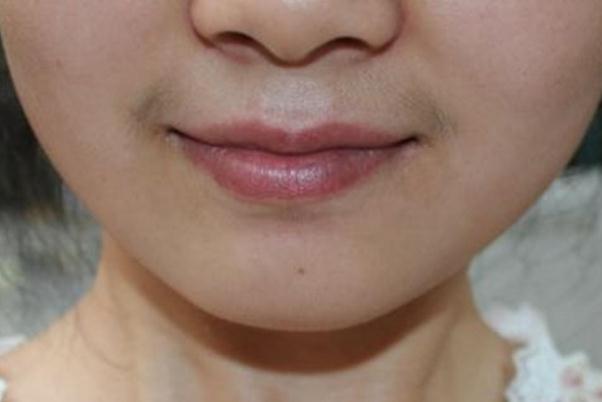 唇毛可以刮嗎 唇毛刮了一次不要緊吧 唇毛可以刮嗎 唇毛刮了一次不要緊吧