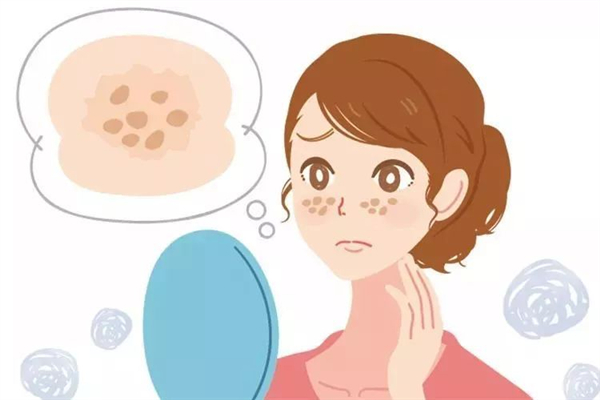 激光祛斑有沒有后遺癥 激光祛斑會留下痕跡嗎 激光祛斑有沒有后遺癥 激光祛斑會留下痕跡嗎