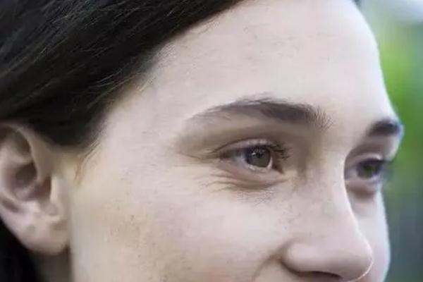 眼部細紋貼眼膜有用嗎 眼部細紋是怎么造成的 眼部細紋貼眼膜有用嗎 眼部細紋是怎么造成的