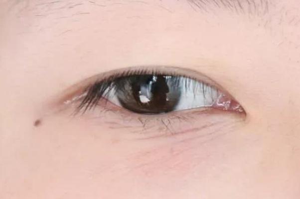 眼部細紋越來越多了怎么改善 眼部細紋松弛最好的解決辦法 眼部細紋越來越多了怎么改善 眼部細紋松弛最好的解決辦法