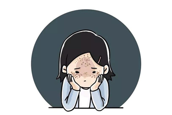 激光祛斑痛不痛 激光祛斑能走醫(yī)保嗎 激光祛斑痛不痛 激光祛斑能走醫(yī)保嗎