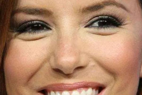 眼部細紋貼眼膜有用嗎 眼部細紋是怎么造成的 眼部細紋貼眼膜有用嗎 眼部細紋是怎么造成的