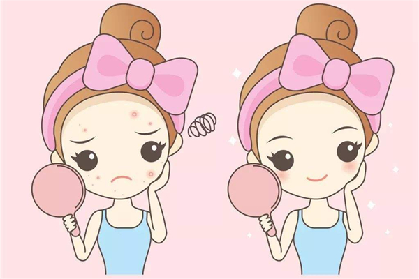 激光祛斑是淡化還是徹底去除 激光祛斑要做幾次才能干凈 激光祛斑是淡化還是徹底去除 激光祛斑要做幾次才能干凈