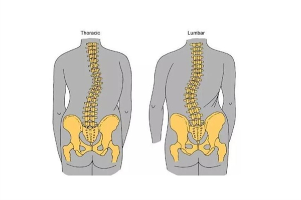 骨盆前傾可以通過正骨恢復(fù)嗎 骨盆前傾去哪里矯正 骨盆前傾可以通過正骨恢復(fù)嗎 骨盆前傾去哪里矯正
