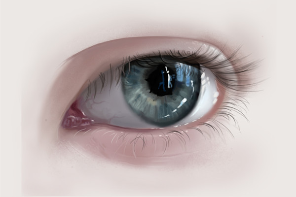 開眼角后多久能化妝 開眼角后幾天拆線 開眼角后多久能化妝 開眼角后幾天拆線