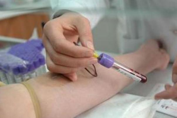 體檢抽血檢查哪些項(xiàng)目 體檢抽血需要空腹嗎 體檢抽血檢查哪些項(xiàng)目 體檢抽血需要空腹嗎