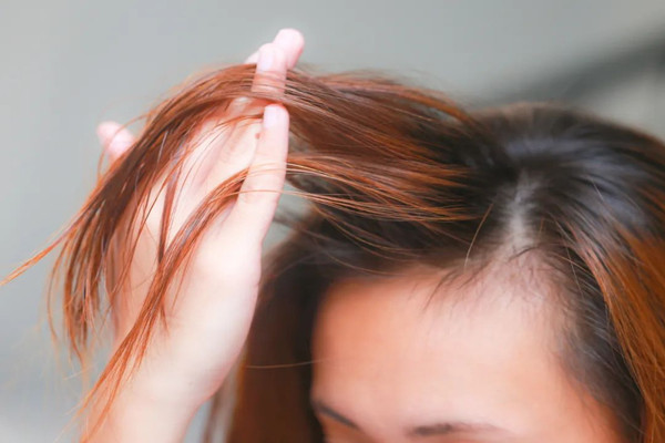 頭發(fā)細軟怎么改善 頭發(fā)細軟適合燙發(fā)嗎 頭發(fā)細軟怎么改善 頭發(fā)細軟適合燙發(fā)嗎