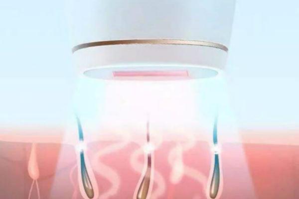 激光脫毛的注意事項 激光脫毛的副作用有哪些 激光脫毛的注意事項 激光脫毛的副作用有哪些