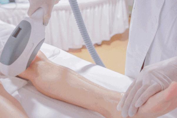 冰點脫毛能永久去除嗎 冰點脫毛的價格多少 冰點脫毛能永久去除嗎 冰點脫毛的價格多少