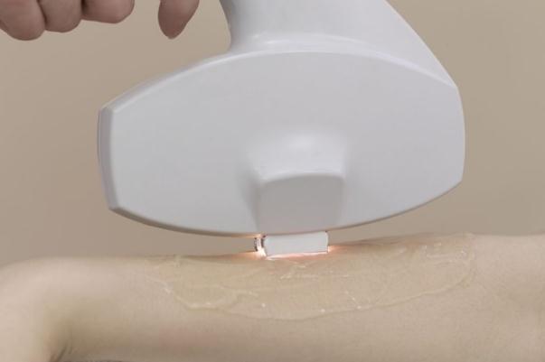 冰點脫毛隔十天能做么 冰點脫毛對身體有沒有傷害 冰點脫毛隔十天能做么 冰點脫毛對身體有沒有傷害