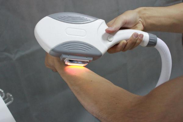 冰點脫毛會影響汗腺的排出嗎 冰點脫毛會傷害皮膚嗎 冰點脫毛會影響汗腺的排出嗎 冰點脫毛會傷害皮膚嗎