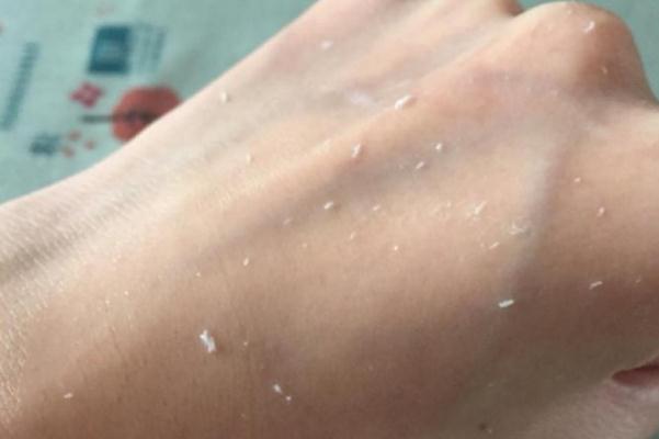 去角質(zhì)對(duì)皮膚有傷害嗎 去角質(zhì)的作用與功效是什么 去角質(zhì)對(duì)皮膚有傷害嗎 去角質(zhì)的作用與功效是什么