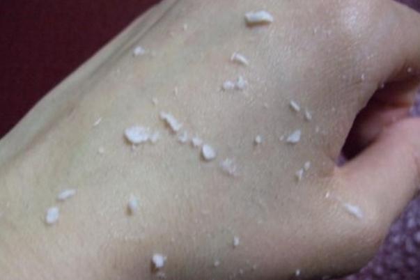 去角質(zhì)要先卸妝嗎 去角質(zhì)要多久一次 去角質(zhì)要先卸妝嗎 去角質(zhì)要多久一次