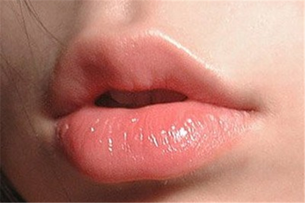 豐唇有什么危害嗎 豐唇會(huì)失敗嗎 豐唇有什么危害嗎 豐唇會(huì)失敗嗎