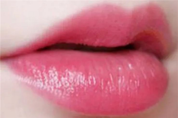 豐唇后多久可以涂口紅 豐唇后怎么護(hù)理 豐唇后多久可以涂口紅 豐唇后怎么護(hù)理