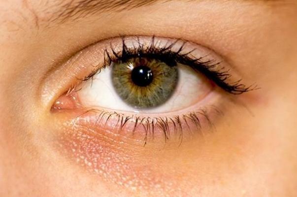 黑眼圈能自己消除嗎 黑眼圈手術(shù)一般多少錢 黑眼圈能自己消除嗎 黑眼圈手術(shù)一般多少錢