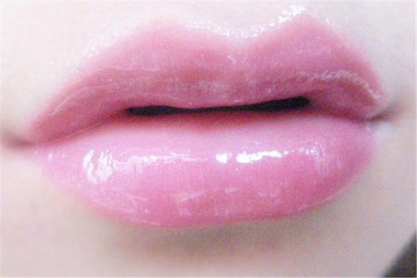 豐唇和嘟嘟唇一樣嗎 豐唇和嘟嘟唇的區(qū)別 豐唇和嘟嘟唇一樣嗎 豐唇和嘟嘟唇的區(qū)別