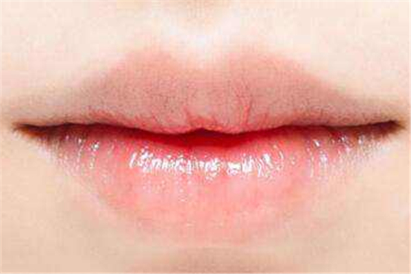 豐唇后多久可以涂口紅 豐唇后怎么護(hù)理 豐唇后多久可以涂口紅 豐唇后怎么護(hù)理