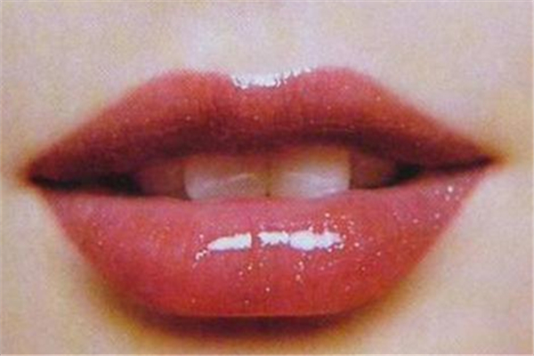 豐唇后多久消腫 豐唇后要冰敷嗎 豐唇后多久消腫 豐唇后要冰敷嗎