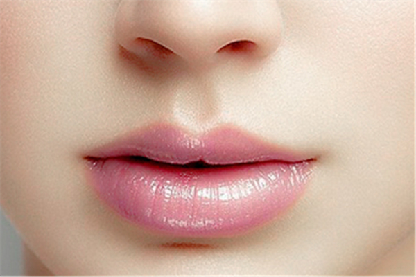 豐唇會(huì)使人中變短嗎 豐唇后有淤青正常嗎 豐唇會(huì)使人中變短嗎 豐唇后有淤青正常嗎