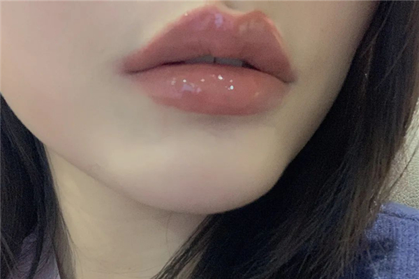 豐唇后多久消腫 豐唇后要冰敷嗎 豐唇后多久消腫 豐唇后要冰敷嗎
