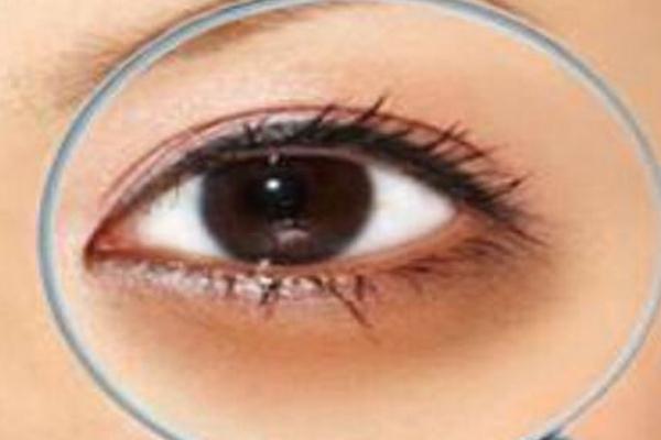 黑眼圈有天生的嗎 黑眼圈有白色顆粒是什么 黑眼圈有天生的嗎 黑眼圈有白色顆粒是什么