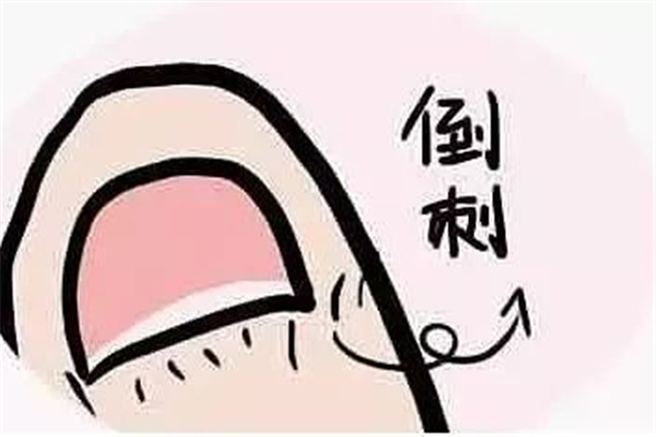 手長(zhǎng)倒刺涂護(hù)手霜有用嗎 手上倒刺涂什么比較好 手長(zhǎng)倒刺涂護(hù)手霜有用嗎 手上倒刺涂什么比較好