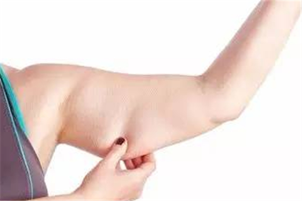 拜拜肉可以抽脂嗎 拜拜肉抽脂危險嗎