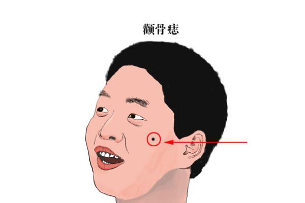 點(diǎn)痣對身體健康有影響嗎 點(diǎn)痣對懷孕有影響嗎 點(diǎn)痣對身體健康有影響嗎 點(diǎn)痣對懷孕有影響嗎