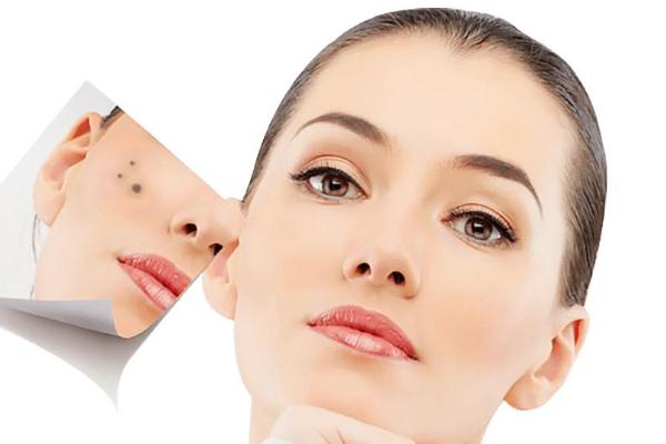 點痣去醫(yī)院掛什么科 點痣后需要注意什么事項 點痣去醫(yī)院掛什么科 點痣后需要注意什么事項