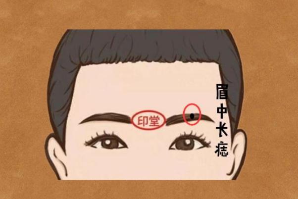 點(diǎn)痣對(duì)身體健康有影響嗎 點(diǎn)痣對(duì)懷孕有影響嗎 點(diǎn)痣對(duì)身體健康有影響嗎 點(diǎn)痣對(duì)懷孕有影響嗎