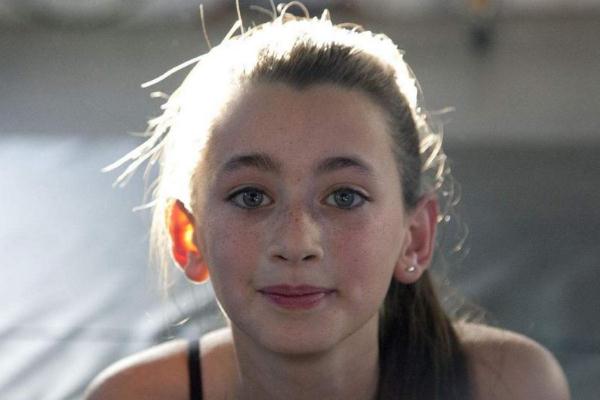 雀斑會(huì)變成黃褐斑嗎 雀斑會(huì)一直長(zhǎng)嗎 雀斑會(huì)變成黃褐斑嗎 雀斑會(huì)一直長(zhǎng)嗎