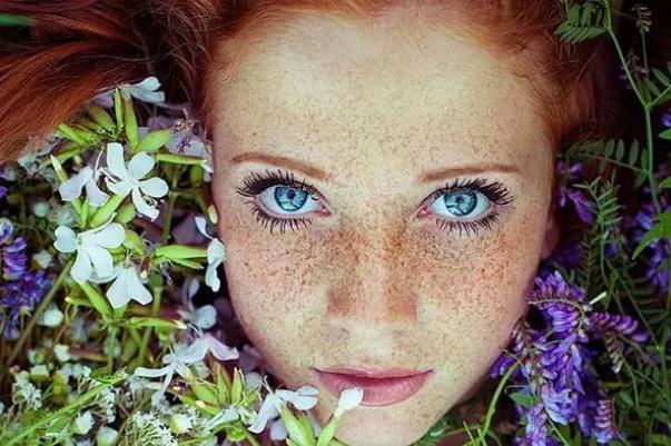 雀斑去除一般要多少錢 雀斑和黃褐斑有什么區(qū)別 雀斑去除一般要多少錢 雀斑和黃褐斑有什么區(qū)別