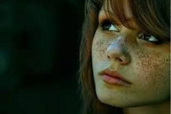 雀斑的形狀和顏色 雀斑的危害 雀斑的形狀和顏色 雀斑的危害