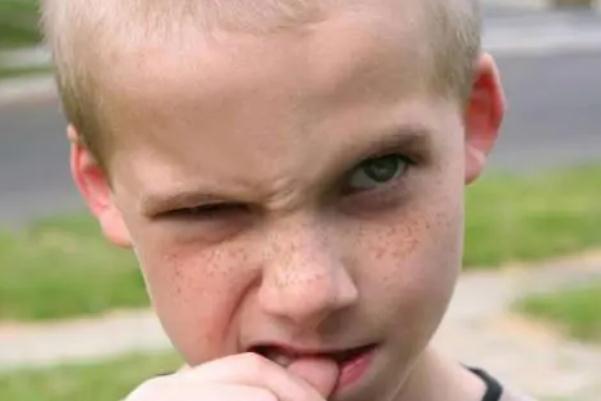 雀斑去除一般要多少錢 雀斑和黃褐斑有什么區(qū)別 雀斑去除一般要多少錢 雀斑和黃褐斑有什么區(qū)別