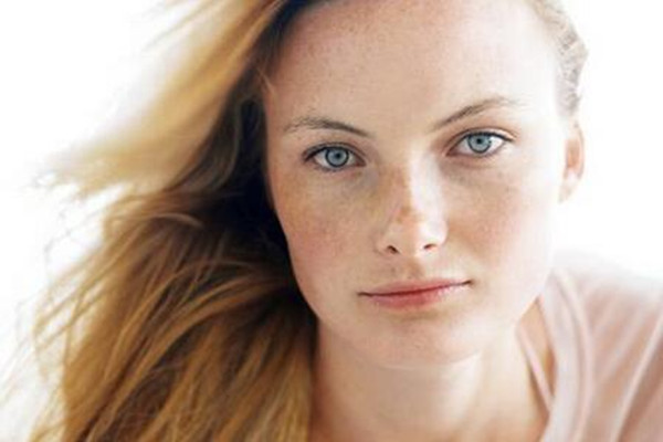 曬斑是黃褐斑的一種嗎 曬斑是老年斑嗎 曬斑是黃褐斑的一種嗎 曬斑是老年斑嗎