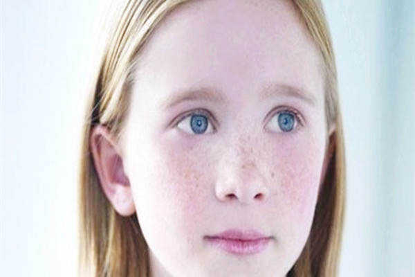 曬斑是黃褐斑的一種嗎 曬斑是老年斑嗎 曬斑是黃褐斑的一種嗎 曬斑是老年斑嗎